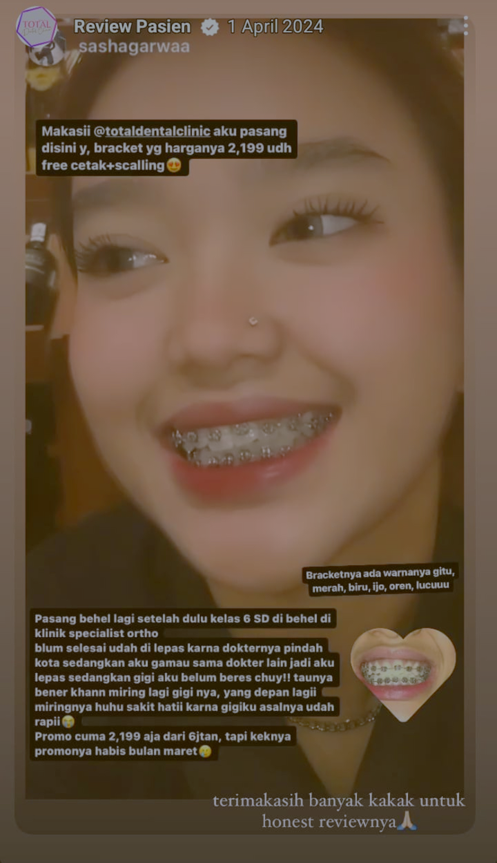 Behel/Braces