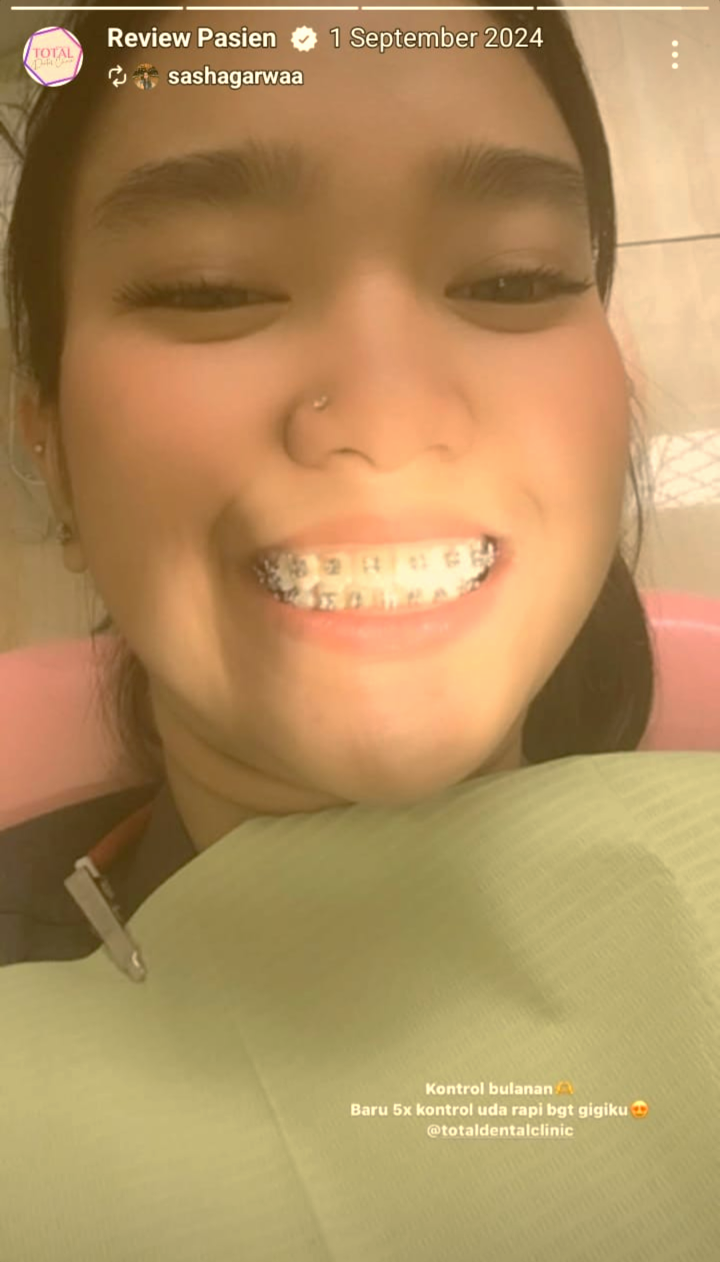 Smile
